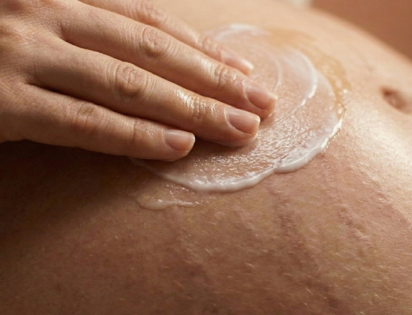 Anti-Stretch Mark Serum