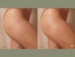 Anti-Stretch Mark Serum