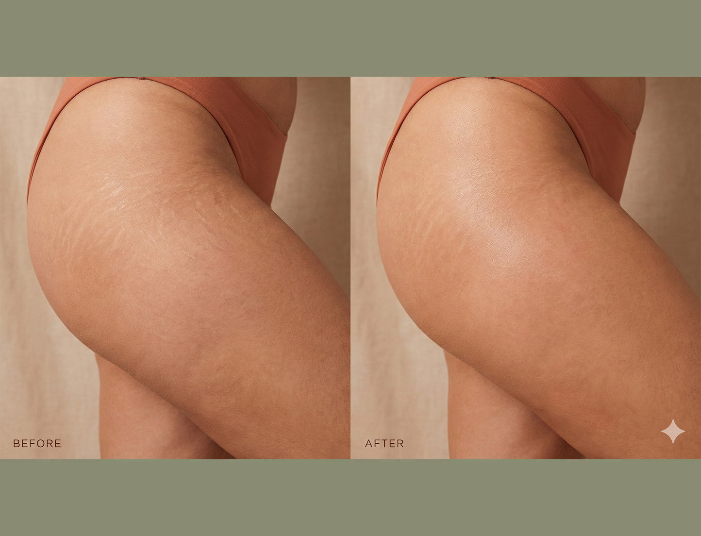 Anti-Stretch Mark Serum